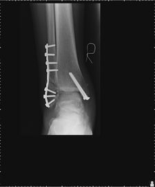 Patient 9