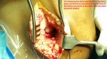 Patient 10 image