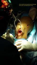 Patient 12 image