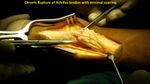 Patient 11 image