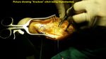 Patient 11 image