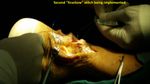Patient 11 image