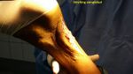 Patient 11 image
