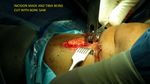 Patient 13 image