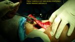 Patient 13 image