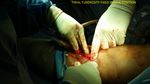 Patient 13 image
