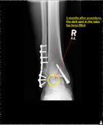 Patient 9 image