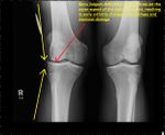 Patient 14 image