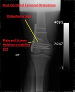 Patient 14 image
