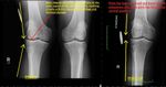 Patient 14 image