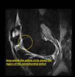 Patient 10 image