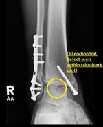 Patient 9 image
