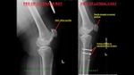 Patient 13 image