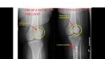 Patient 13 image