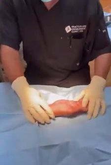 Patient 24