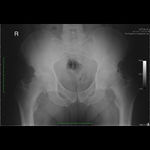 Patient 1 image