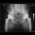 Patient 1 image