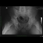 Patient 1 image