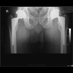 Patient 1 image