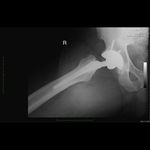 Patient 1 image