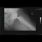 Patient 1 image
