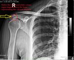 Patient 7 image