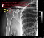 Patient 7 image