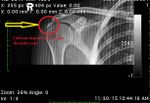 Patient 8 image