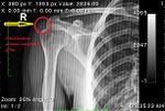 Patient 8 image